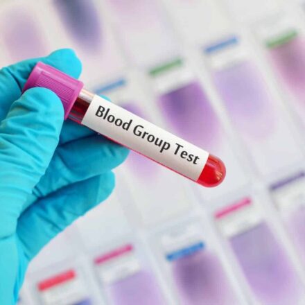 Here’s How to Figure Out Your Blood Type At Home